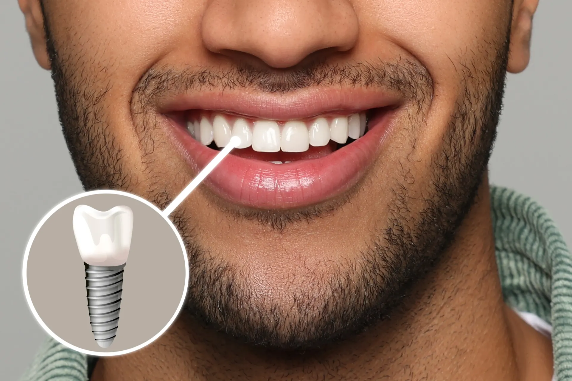 Ready to Replace Missing Teeth?