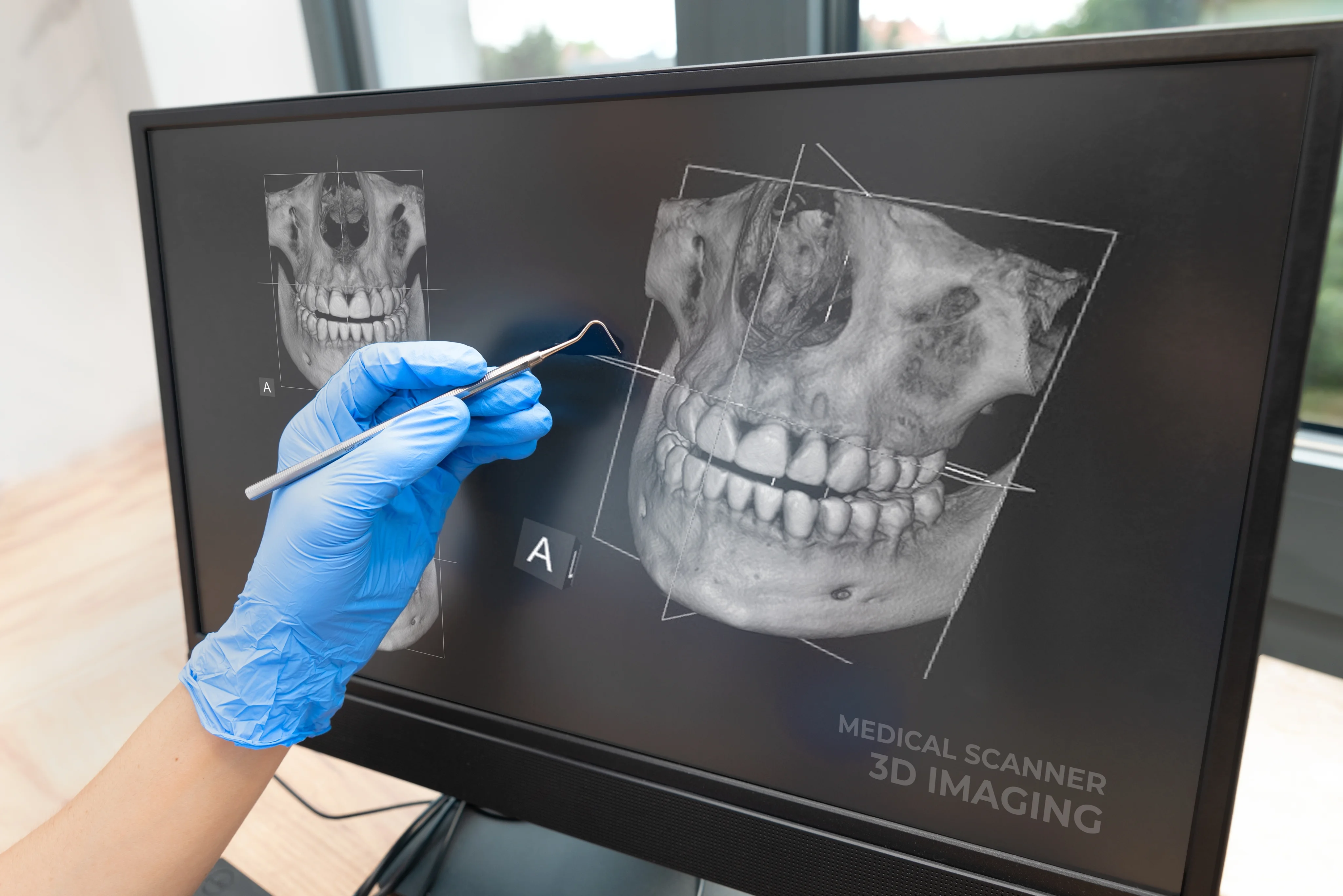 Digital X-Rays