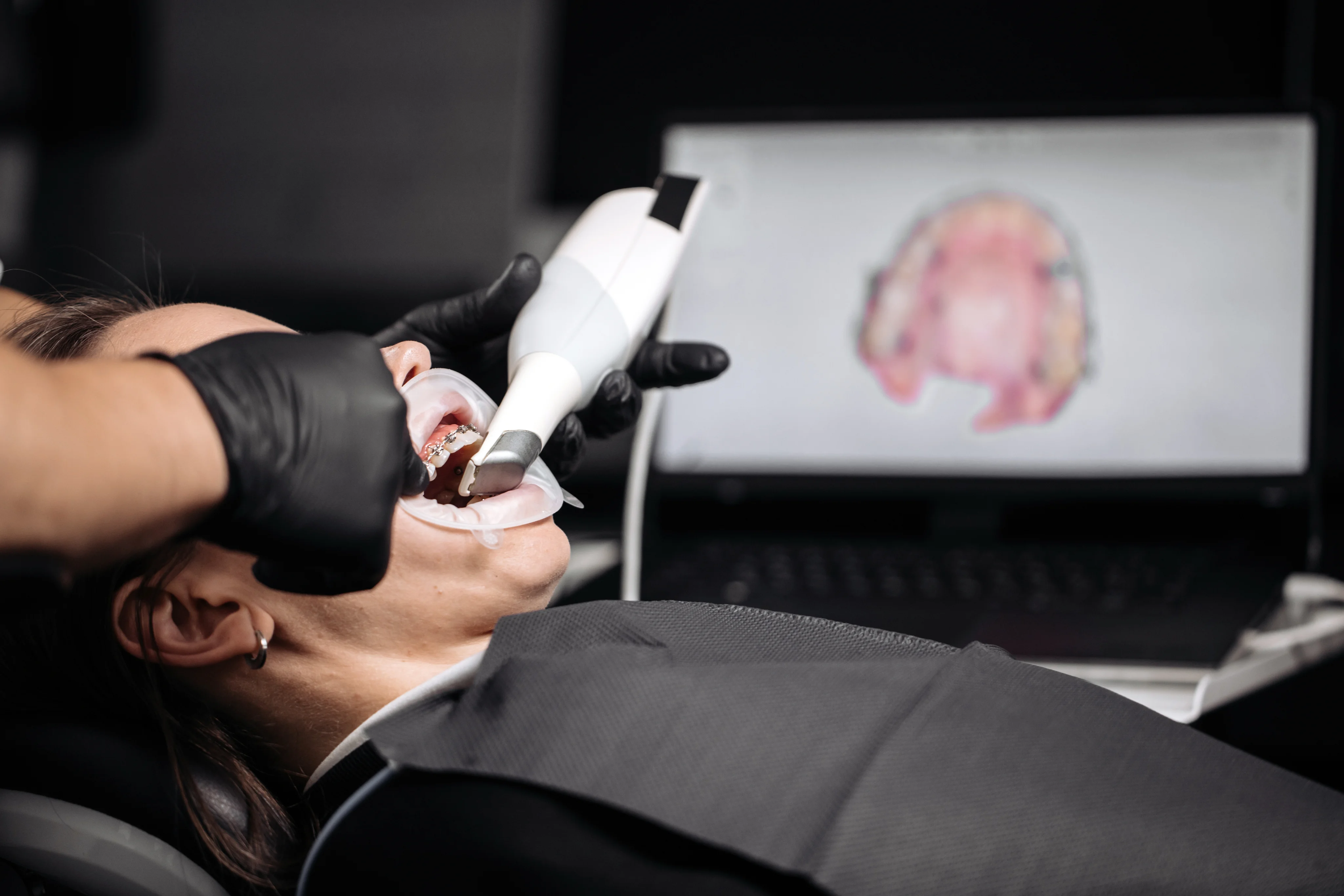 Intraoral Camera