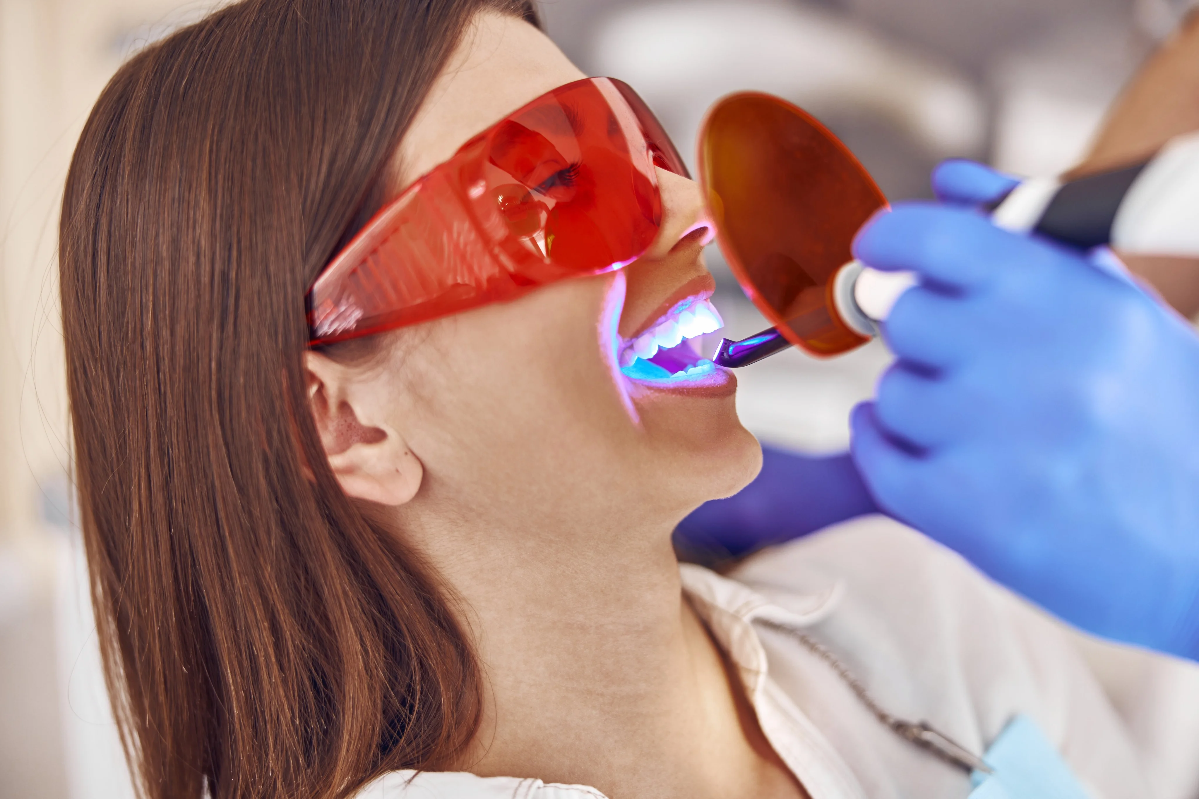 Teeth whitening