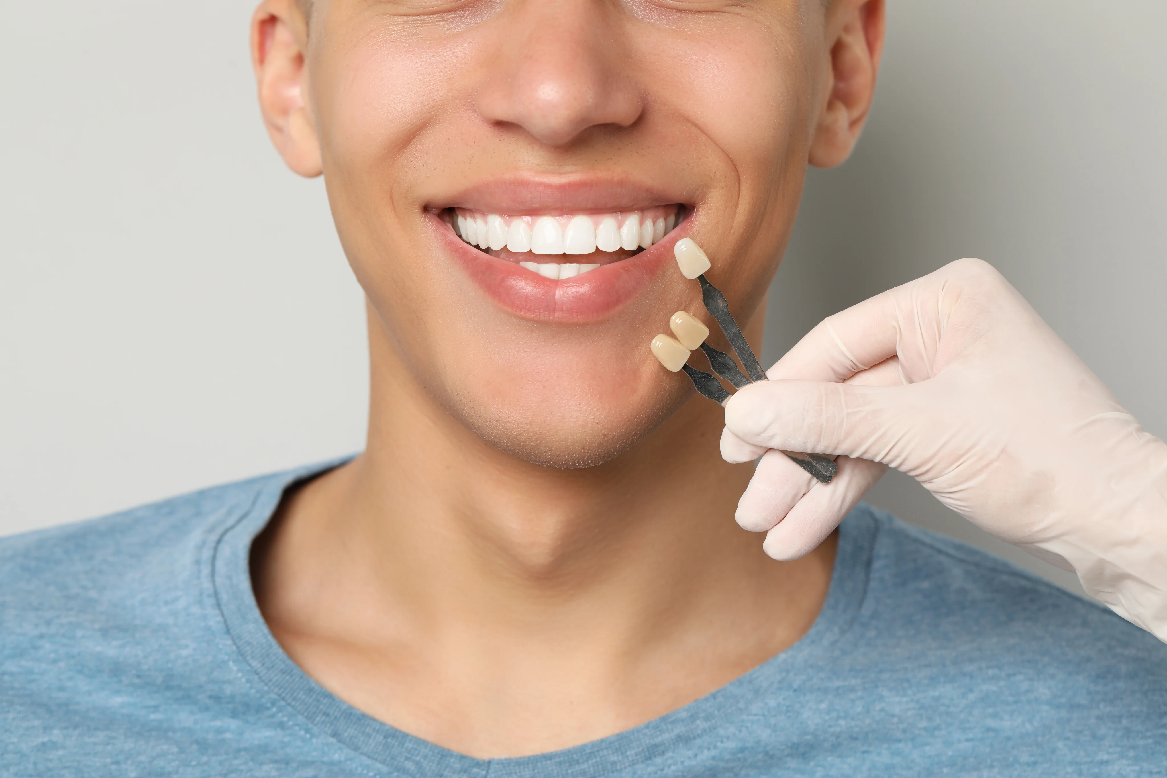 Dental Veneers in Campbell, CA